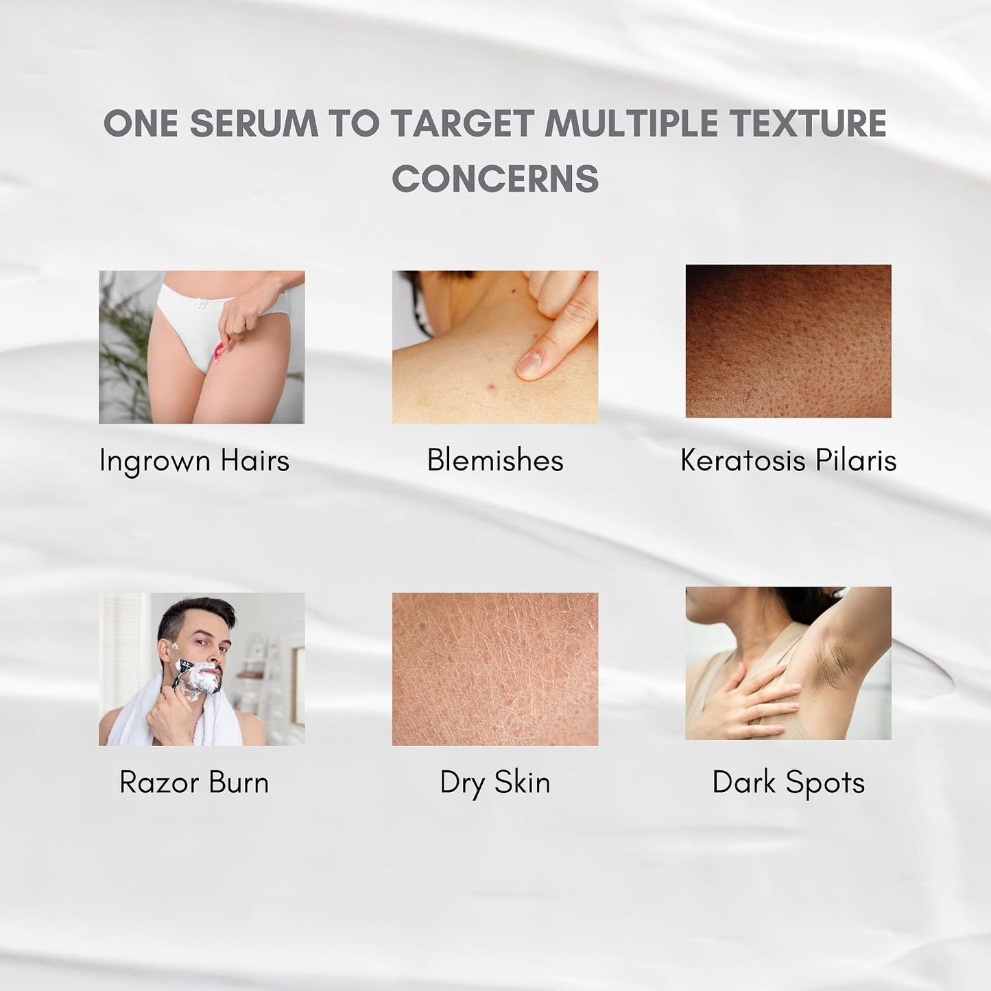 KP body and face serum shown for keratosis pilaris care