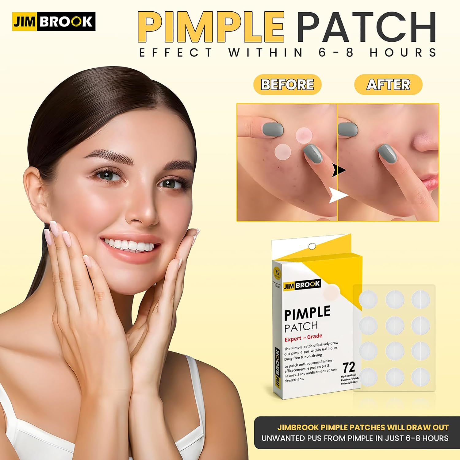 Pimple patch applied over a blemish for discreet spot treatment