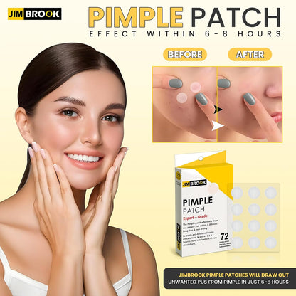 Pimple patch applied over a blemish for discreet spot treatment