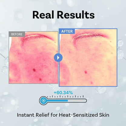 Exosome ampoule serum shown with its Korean skincare packaging