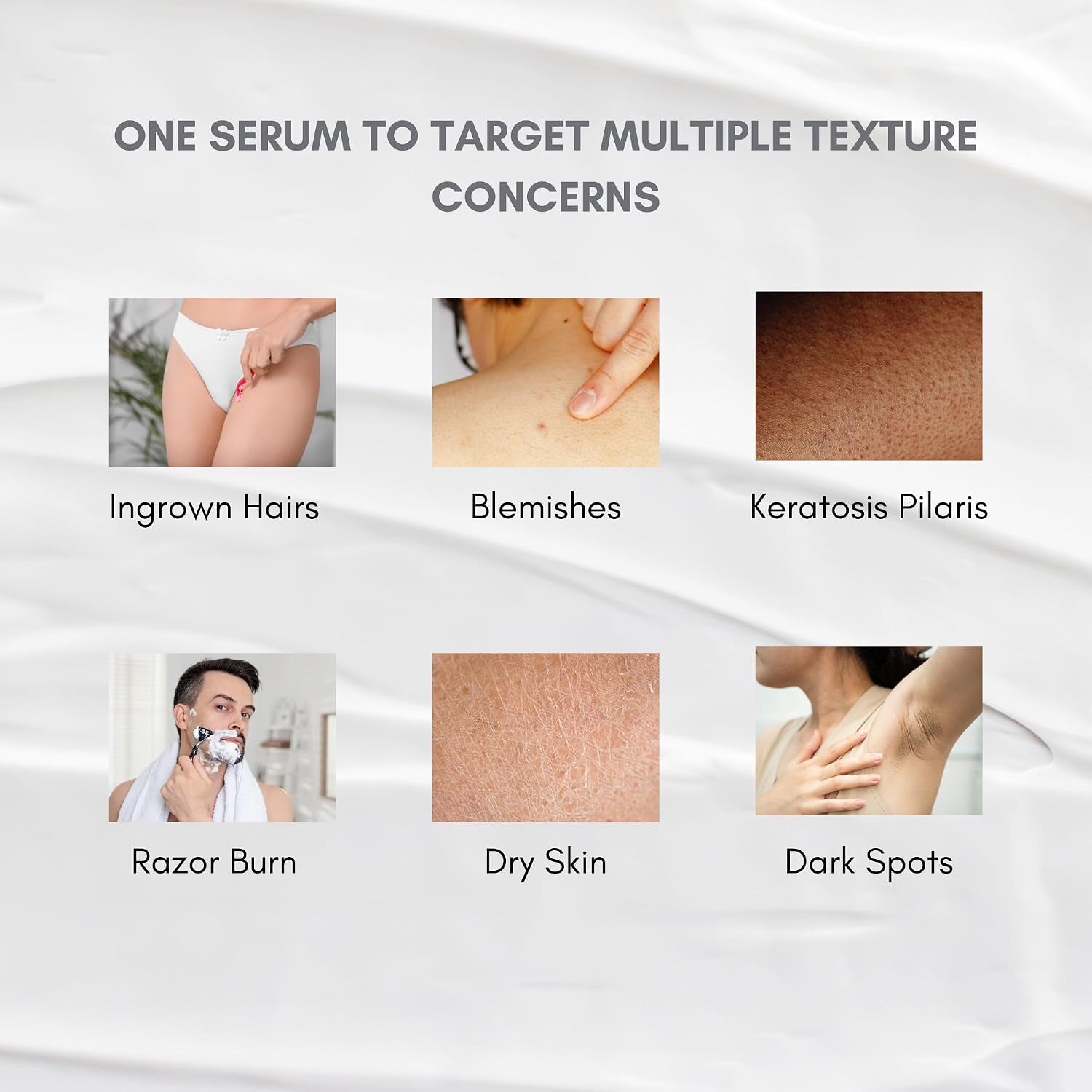 KP body and face serum shown for keratosis pilaris care